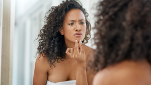 The Habit That Causes Breakouts