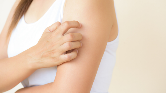 5 Tips To Deal With Dry Skin